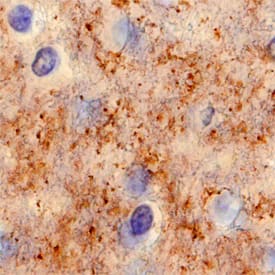 Syntaxin 1A was detected in immersion fixed paraffin-embedded sections of human brain using Mouse Anti-Human Syntaxin 1A Monoclonal Antibody (Catalog # MAB7237) at 15 µg/mL overnight at 4 °C. Before incubation with the primary antibody, tissue was subjected to heat-induced epitope retrieval using Antigen Retrieval Reagent-Basic (Catalog # CTS013). Tissue was stained using the Anti-Mouse HRP-DAB Cell & Tissue Staining Kit (brown; Catalog # CTS002) and counterstained with hematoxylin (blue). Specific staining was localized to synaptic puncta. View our protocol for Chromogenic IHC Staining of Paraffin-embedded Tissue Sections.