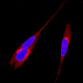 Immunocytochemistry Syntaxin 5 Antibody [Unconjugated]