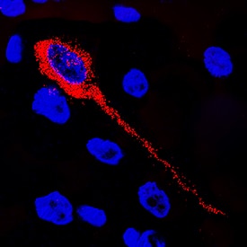 Syntaxin 5 was detected in immersion fixed frozen sections of rat brain using Goat Anti-Human/Rat Syntaxin 5 Antigen Affinity-purified Polyclonal Antibody (Catalog # AF5687) at 3 µg/mL overnight at 4 °C. Tissue was stained using the NorthernLights™ 557-conjugated Anti-Goat IgG Secondary Antibody (red; Catalog # NL001) and counterstained with DAPI (blue). Specific staining was localized to neuronal cytoplasm. View our protocol for Fluorescent IHC Staining of Frozen Tissue Sections.