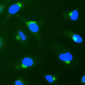 Syntaxin 6 was detected in immersion fixed HeLa human cervical epithelial carcinoma cell line using Sheep Anti-Human Syntaxin 6 Antigen Affinity-purified Polyclonal Antibody (Catalog # AF5664) at 1.7 µg/mL for 3 hours at room temperature. Cells were stained using the NorthernLights™ 493-conjugated Anti-Sheep IgG Secondary Antibody (green; Catalog # NL012) and counterstained with DAPI (blue). Specific staining was localized to Golgi vesicles. View our protocol for Fluorescent ICC Staining of Cells on Coverslips.