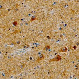 Syntaxin 6 was detected in immersion fixed paraffin-embedded sections of human brain (cortex) using Sheep Anti-Human Syntaxin 6 Antigen Affinity-purified Polyclonal Antibody (Catalog # AF5664) at 5 µg/mL overnight at 4 °C. Tissue was stained using the Anti-Sheep HRP-DAB Cell & Tissue Staining Kit (brown; Catalog # CTS019) and counter-stained with hematoxylin (blue). Specific staining was localized to the cytoplasm of neurons. View our protocol for Chromogenic IHC Staining of Paraffin-embedded Tissue Sections.