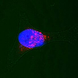 Immunocytochemistry Syntaxin 7 Antibody [Unconjugated]