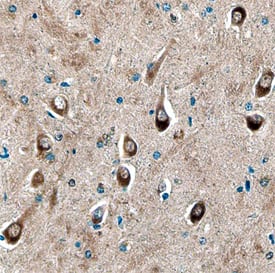 Immunohistochemistry Syntaxin 8 Antibody