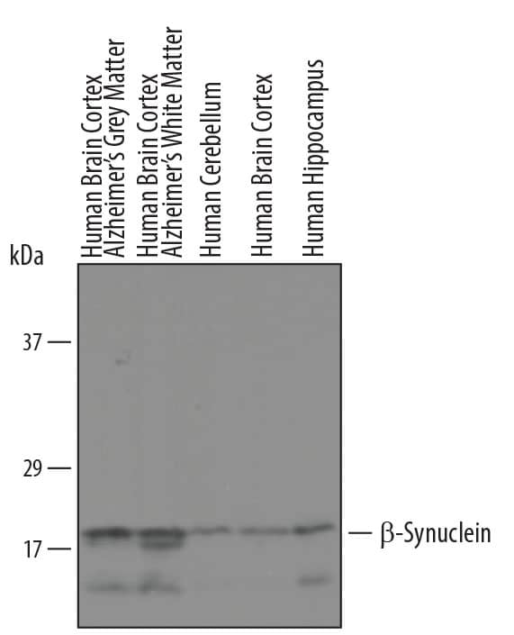 Western blot shows lysates of human brain cortex, Alzheimer grey matter and white matter, and human cerebellum, brain cortex, and hippocampus tissue. PVDF membrane was probed with 1 µg/mL of Human  beta -Synuclein Antigen Affinity-purified Polyclonal Antibody (Catalog # AF5528) followed by HRP-conjugated Anti-Sheep IgG Secondary Antibody (Catalog # HAF016). A specific band was detected for  beta -Synuclein at approximately 19 kDa (as indicated). This experiment was conducted under reducing conditions and using Immunoblot Buffer Group 8.