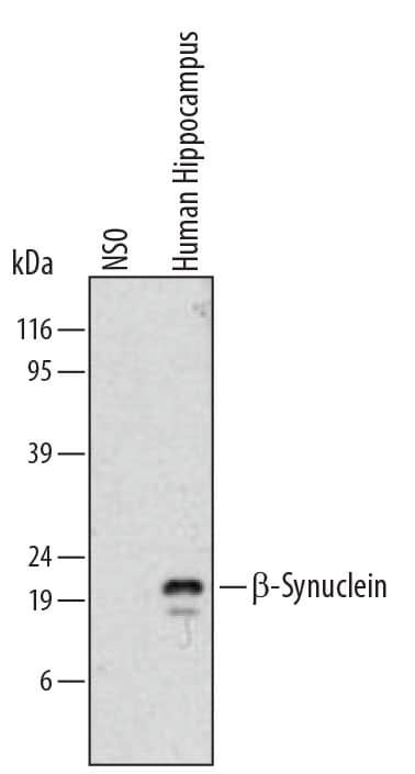 Western blot shows lysates of human hippocampal tissue. PVDF membrane was probed with 2 µg/mL of Mouse Anti-Human  beta -Synuclein Monoclonal Antibody (Catalog # MAB5528) followed by HRP-conjugated Anti-Mouse IgG Secondary Antibody (HAF007). A specific band was detected for  beta -Synuclein at approximately 20 kDa (as indicated). This experiment was conducted under reducing conditions and using Immunoblot Buffer Group 1.