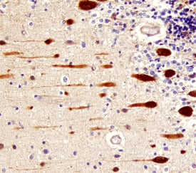 gamma-Synuclein was detected in immersion fixed paraffin-embedded sections of human cerebellum using Human gamma-Synuclein Antigen Affinity Purified Polyclonal Antibody (Catalog # AF5745) at 1.7 µg/mL overnight at 4 °C. Tissue was stained using the Anti-Sheep HRP-DAB Cell & Tissue Staining Kit (brown; Catalog # CTS019) and counterstained with hematoxylin (blue). View our protocol for Chromogenic IHC Staining of Paraffin-embedded Tissue Sections.