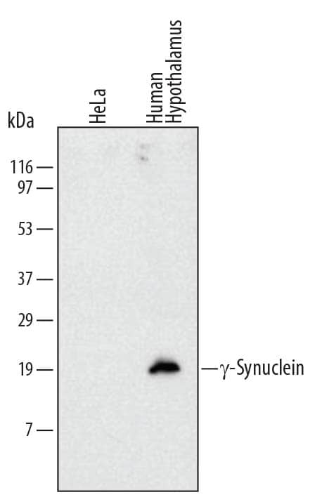 Western Blot gamma-Synuclein Antibody (514304) [Unconjugated]