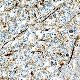 a-Synuclein was detected in immersion fixed paraffin-embedded sections of human brain (hypothalamus) using Goat Anti-Human a-Synuclein Antigen Affinity-purified Polyclonal Antibody (Catalog # AF1338) at 15 µg/mL overnight at 4 °C. Tissue was stained using the Anti-Goat HRP-DAB Cell & Tissue Staining Kit (brown; CTS008) and counterstained with hematoxylin (blue). Specific staining was localized to neuronal processes. View our protocol for Chromogenic IHC Staining of Paraffin-embedded Tissue Sections.