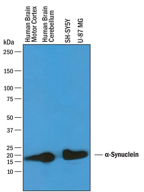 Western blot shows lysates of human brain (motor cortex) tissue, human brain (cerebellum) tissue, SH-SY5Y human neuroblastoma cell line, and U-87 MG human glioblastoma/astrocytoma cell line. PVDF membrane was probed with 1 µg/mL of Goat Anti-Human a-Synuclein Antigen Affinity-purified Polyclonal Antibody (Catalog # AF1338) followed by HRP-conjugated Anti-Goat IgG Secondary Antibody (HAF019). A specific band was detected for a-Synuclein at approximately 18 kDa (as indicated). This experiment was conducted under reducing conditions and using Immunoblot Buffer Group 1.