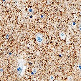 a-Synuclein was detected in immersion fixed paraffin-embedded sections of human brain (substantia nigra) using Mouse Anti-Human/Mouse/Rat a-Synuclein Monoclonal Antibody (Catalog # MAB13381) at 15 µg/mL overnight at 4 °C. Tissue was stained using the Anti-Mouse HRP-DAB Cell & Tissue Staining Kit (brown; Catalog # CTS002) and counterstained with hematoxylin (blue). Specific staining was localized to synaptic varicosities. View our protocol for Chromogenic IHC Staining of Paraffin-embedded Tissue Sections.