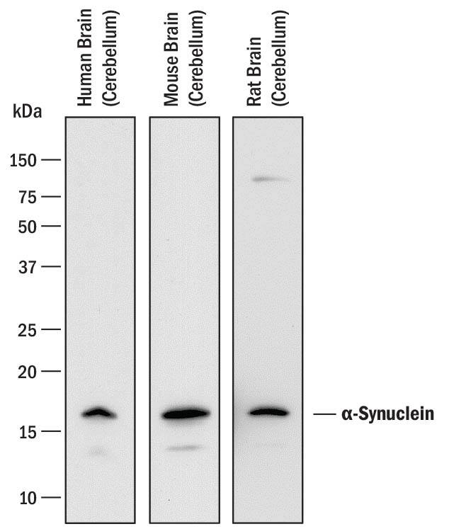 Western blot shows lysates of human brain (cerebellum) tissue, mouse brain (cerebellum) tissue, and rat brain (cerebellum) tissue. PVDF membrane was probed with 2 µg/mL of Mouse Anti-Human/Mouse/Rat a-Synuclein Monoclonal Antibody (Catalog # MAB13381) followed by HRP-conjugated Anti-Mouse IgG Secondary Antibody (Catalog # HAF018). A specific band was detected for a-Synuclein at approximately 17 kDa (as indicated). This experiment was conducted under reducing conditions and using Immunoblot Buffer Group 1.