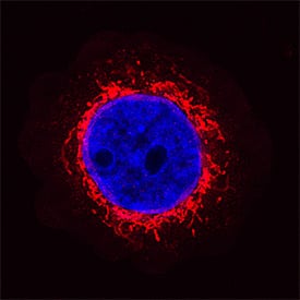 gamma-Synuclein was detected in immersion fixed MBA-MB-468 human breast cancer cell line using Recombinant Mouse Anti-Human gamma-Synuclein Monoclonal Antibody (Catalog # MAB5745R) at 1.7 µg/mL for 3 hours at room temperature. Cells were stained using the NorthernLights™ 557-conjugated Anti-Mouse IgG Secondary Antibody (red; Catalog # NL007) and counterstained with DAPI (blue). Specific staining was localized to cytoplasm. View our protocol for Fluorescent ICC Staining of Non-adherent Cells.