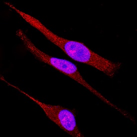 Immunocytochemistry TAB1 Antibody [Unconjugated]