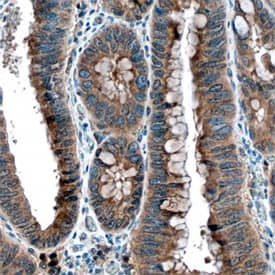 TACE/ADAM17 was detected in immersion fixed paraffin-embedded sections of human colon using Goat Anti-Human TACE/ADAM17 Antigen Affinity-purified Polyclonal Antibody (Catalog # AF9301) at 3 µg/mL overnight at 4 °C. Before incubation with the primary antibody, tissue was subjected to heat-induced epitope retrieval using Antigen Retrieval Reagent-Basic (Catalog # CTS013). Tissue was stained using the Anti-Goat HRP-DAB Cell & Tissue Staining Kit (brown; Catalog # CTS008) and counterstained with hematoxylin (blue). Specific staining was localized to epithelial cells. View our protocol for Chromogenic IHC Staining of Paraffin-embedded Tissue Sections.