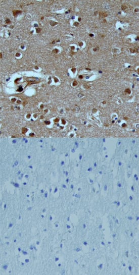Immunohistochemistry TAFA1/FAM19A1 Antibody [Unconjugated]