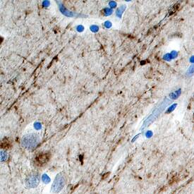 TAFA2/FAM19A2 was detected in immersion fixed paraffin-embedded sections of human brain (cortex) using Human TAFA2/FAM19A2 Antigen Affinity-purified Polyclonal Antibody (Catalog # AF4179) at 10 µg/mL overnight at 4 °C. Before incubation with the primary antibody, tissue was subjected to heat-induced epitope retrieval using Antigen Retrieval Reagent-Basic (Catalog # CTS013). Tissue was stained using the Anti-Sheep HRP-DAB Cell & Tissue Staining Kit (brown; Catalog # CTS019) and counterstained with hematoxylin (blue). Specific staining was localized to neuronal processes. View our protocol for Chromogenic IHC Staining of Paraffin-embedded Tissue Sections.