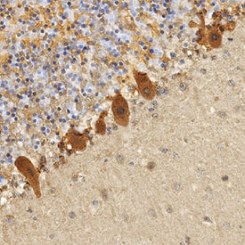 Immunohistochemistry TAFA5/FAM19A5 Antibody (463102) [Unconjugated]