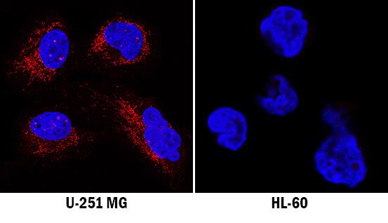 TAP2 was detected in immersion fixed U-251 MG human glioblastoma cell line (left panel) and HL-60 human acute promyelocytic leukemia cell line (right panel, negative control) using Mouse Anti-Human TAP2 Monoclonal Antibody (Catalog # MAB2432) at 8 µg/mL for 3 hours at room temperature. Cells were stained using the NorthernLights™ 557-conjugated Anti-Mouse IgG Secondary Antibody (red; Catalog # NL007) and counterstained with DAPI (blue). Specific staining was localized to cytoplasm. View our protocol for Fluorescent ICC Staining of Cells on Coverslips.