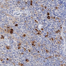 TAP2 was detected in immersion fixed paraffin-embedded sections of human tonsil using Mouse Anti-Human TAP2 Monoclonal Antibody (Catalog # MAB2432) at 8 µg/mL for 1 hour at room temperature followed by incubation with the Anti-Mouse IgG VisUCyte™ HRP Polymer Antibody (Catalog # VC001). Before incubation with the primary antibody, tissue was subjected to heat-induced epitope retrieval using Antigen Retrieval Reagent-Basic (Catalog # CTS013). Tissue was stained using DAB (brown) and counterstained with hematoxylin (blue). Specific staining was localized to cytoplasm in lymphocytes. View our protocol for IHC Staining with VisUCyte HRP Polymer Detection Reagents.