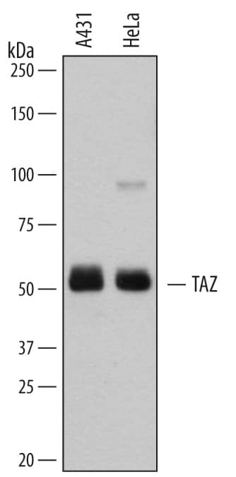 Western blot shows lysates of A431 human epithelial carcinoma cell line and HeLa human cervical epithelial carcinoma cell line. PVDF membrane was probed with 0.2 µg/mL of Goat Anti-Human TAZ/WWTR1 Antigen Affinity-purified Polyclonal Antibody (Catalog # AF7210) followed by HRP-conjugated Anti-Goat IgG Secondary Antibody (Catalog # HAF109). A specific band was detected for TAZ/WWTR1 at approximately 50-55 kDa (as indicated). This experiment was conducted under reducing conditions and using Immunoblot Buffer Group 1.