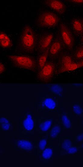 Immunocytochemistry TBX18 Antibody (635305) [Unconjugated]