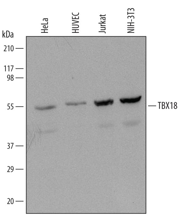Western blot shows lysates of HeLa human cervical epithelial carcinoma cell line, HUVEC human umbilical vein endothelial cells, Jurkat human acute T cell leukemia cell line, and NIH-3T3 mouse embryonic fibroblast cell line. PVDF Membrane was probed with 0.5 µg/mL of Mouse Anti-Human TBX18 Monoclonal Antibody (Catalog # MAB6337) followed by HRP-conjugated Anti-Mouse IgG Secondary Antibody (Catalog # HAF007). A specific band was detected for TBX18 at approximately 65 kDa (as indicated). This experiment was conducted under reducing conditions and using Immunoblot Buffer Group 1.