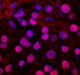 Immunocytochemistry TBX20 Antibody (668710)