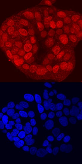 Immunocytochemistry TBX2 Antibody (393720) [Unconjugated]