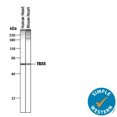 Simple Western lane view shows lysates of human heart tissue and mouse heart tissue, loaded at 0.2 mg/mL. A specific band was detected for TBX5 at approximately 56 kDa (as indicated) using 50 µg/mL of Sheep Anti-Human/Mouse TBX5 Antigen Affinity-purified Polyclonal Antibody (Catalog # AF5918) followed by 1:50 dilution of HRP-conjugated Anti-Sheep IgG Secondary Antibody (Catalog # HAF016). This experiment was conducted under reducing conditions and using the 12-230 kDa separation system. Non-specific interaction with the 230 kDa Simple Western standard may be seen with this antibody.