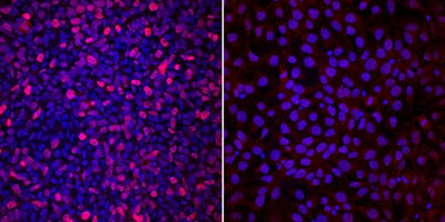 Immunocytochemistry TBX6 Antibody [Unconjugated]