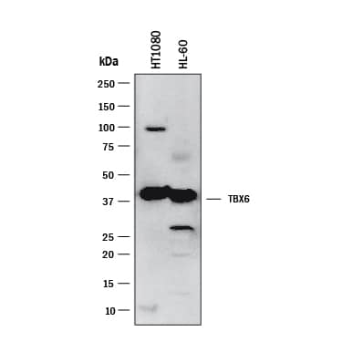 Western Blot TBX6 Antibody [Unconjugated]