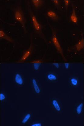 TCF-3/E2A was detected in immersion fixed HeLa human cervical epithelial carcinoma cell line using Human TCF-3/E2A Monoclonal Antibody (Catalog # MAB44061) at 10 µg/mL for 3 hours at room temperature. Cells were stained using the NorthernLights™ 557-conjugated Anti-Rat IgG Secondary Antibody (red; Catalog # NL013) and counterstained with DAPI (blue). Specific staining was localized to nucleoli. View our protocol for Fluorescent ICC Staining of Cells on Coverslips.