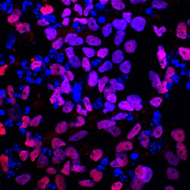 TCF-2/HNF-1 beta  was detected in immersion fixed BG01V human embryonic stem cells differentiated into pancreatic progenitor cells using Goat Anti-Human TCF-2/HNF-1 beta  Antigen Affinity-purified Polyclonal Antibody (Catalog # AF3330) at 10 µg/mL for 3 hours at room temperature. Cells were stained using the NorthernLights™ 557-conjugated Anti-Goat IgG Secondary Antibody (red;NL001) and counterstained with DAPI (blue). Specific staining was localized to nuclei. View our protocol for Fluorescent ICC Staining of Stem Cells on Coverslips.
