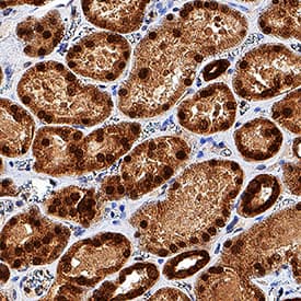 TCF-2/HNF-1 beta  was detected in immersion fixed paraffin-embedded sections of human kidney using Goat Anti-Human TCF-2/HNF-1 beta  Antigen Affinity-purified Polyclonal Antibody (Catalog # AF3330) at 3 µg/mL overnight at 4 °C. Tissue was stained using the Anti-Goat HRP-DAB Cell & Tissue Staining Kit (brown; Catalog # CTS008) and counterstained with hematoxylin (blue). Specific staining was localized to nuclei in convoluted tubules. View our protocol for Chromogenic IHC Staining of Paraffin-embedded Tissue Sections.