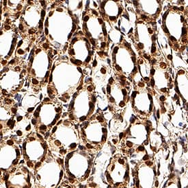 TCF-2/HNF-1 beta  was detected in perfusion fixed frozen sections of rat kidney using Goat Anti-Human TCF-2/HNF-1 beta  Antigen Affinity-purified Polyclonal Antibody (Catalog # AF3330) at 3 µg/mL overnight at 4 °C. Tissue was stained using the Anti-Goat HRP-DAB Cell & Tissue Staining Kit (brown; CTS008) and counterstained with hematoxylin (blue). Specific staining was localized to nuclei in convoluted tubules. View our protocol for Chromogenic IHC Staining of Frozen Tissue Sections.
