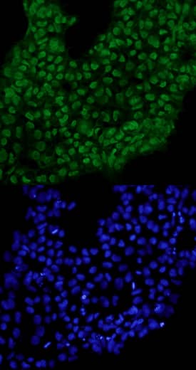 Immunocytochemistry TCF7L1/TCF3 Antibody
