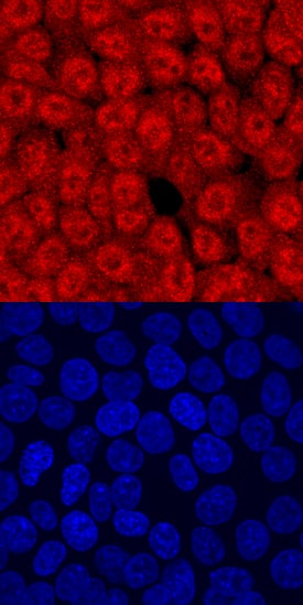 Immunocytochemistry TCF7/TCF1 Antibody [Unconjugated]