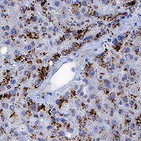 TDO2 was detected in immersion fixed paraffin-embedded sections of human liver using Mouse Anti-Human TDO2 Monoclonal Antibody (Catalog # MAB9768) at 5 µg/mL for 1 hour at room temperature followed by incubation with the Anti-Mouse IgG VisUCyte™ HRP Polymer Antibody (Catalog # VC001). Before incubation with the primary antibody, tissue was subjected to heat-induced epitope retrieval using Antigen Retrieval Reagent-Basic (Catalog # CTS013). Tissue was stained using DAB (brown) and counterstained with hematoxylin (blue). Specific staining was localized to cytoplasm in hepatocytes. View our protocol for IHC Staining with VisUCyte HRP Polymer Detection Reagents.