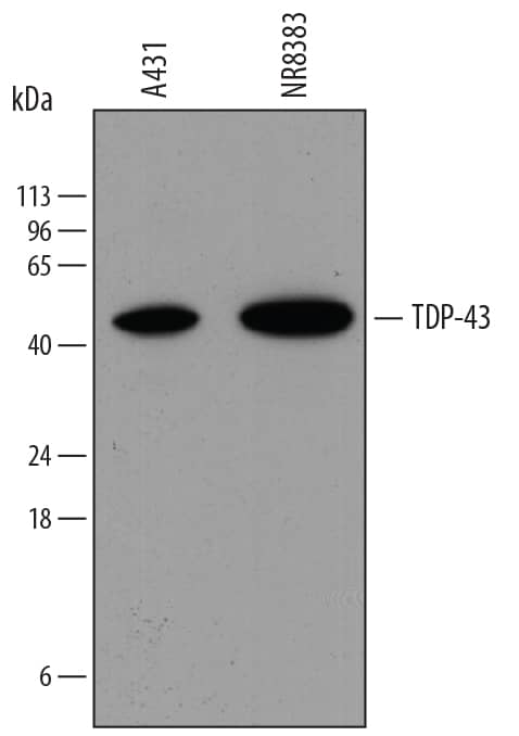 Western blot shows lysates of A431 human epithelial carcinoma cell line and NR8383 rat alveolar macrophage cell line. PVDF membrane was probed with 0.4 µg/mL of Mouse Anti-Human/Mouse/Rat TDP-43/TARDBP Monoclonal Antibody (Catalog # MAB7778) followed by HRP-conjugated Anti-Mouse IgG Secondary Antibody (HAF018). A specific band was detected for TDP-43/TARDBP at approximately 45 kDa (as indicated). This experiment was conducted under reducing conditions and using Immunoblot Buffer Group 1.