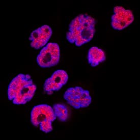 TDP-43/TARDBP was detected in immersion fixed mouse splenocytes using Mouse Anti-Human/Mouse/Rat TDP-43/TARDBP Monoclonal Antibody (Catalog # MAB77781) at 3 µg/mL for 3 hours at room temperature. Cells were stained using the NorthernLights™ 557-conjugated Anti-Mouse IgG Secondary Antibody (red; Catalog # NL007) and counterstained with DAPI (blue). Specific staining was localized to nuclei. View our protocol for Fluorescent ICC Staining of Non-adherent Cells.