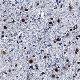 TDP-43/TARDBP was detected in immersion fixed paraffin-embedded sections of human brain (cortex) using Mouse Anti-Human/Mouse/Rat TDP-43/TARDBP Monoclonal Antibody (Catalog # MAB77781) at 3 µg/mL for 1 hour at room temperature followed by incubation with the Anti-Mouse IgG VisUCyte™ HRP Polymer Antibody (Catalog # VC001). Tissue was stained using DAB (brown) and counterstained with hematoxylin (blue). Specific staining was localized to nuclei. View our protocol for IHC Staining with VisUCyte HRP Polymer Detection Reagents.