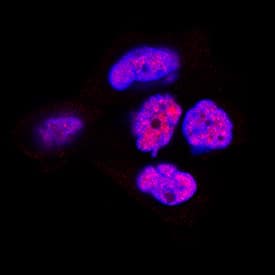 TDP-43/TARDBP was detected in immersion fixed A431 human epithelial carcinoma cell line using Mouse Anti-Human/Mouse/Rat TDP-43/TARDBP Monoclonal Antibody (Catalog # MAB7778) at 1 µg/mL for 3 hours at room temperature. Cells were stained using the NorthernLights™ 557-conjugated Anti-Sheep IgG Secondary Antibody (red; NL010) and counterstained with DAPI (blue). Specific staining was localized to nuclei. View our protocol for Fluorescent ICC Staining of Cells on Coverslips.