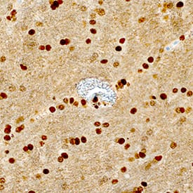 TDP-43/TARDBP was detected in immersion fixed paraffin-embedded sections of human brain (hippocampus) using Mouse Anti-Human/Mouse/Rat TDP-43/TARDBP Monoclonal Antibody (Catalog # MAB7778) at 1.7 µg/mL overnight at 4 °C. Tissue was stained using the Anti-Mouse HRP-DAB Cell & Tissue Staining Kit (brown; CTS002) and counterstained with hematoxylin (blue). Specific staining was localized to nuclei. View our protocol for Chromogenic IHC Staining of Paraffin-embedded Tissue Sections.