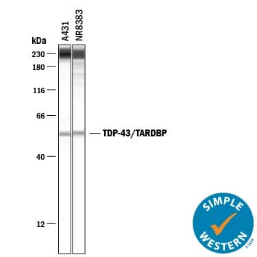 Simple Western lane view shows lysates of A431 human epithelial carcinoma cell line and NR8383 rat alveolar macrophage cell line, loaded at 0.2 mg/mL. A specific band was detected for TDP-43/TARDBP at approximately 54 kDa (as indicated) using 5 µg/mL of Mouse Anti-Human TDP-43/TARDBP Monoclonal Antibody (Catalog # MAB7778) . This experiment was conducted under reducing conditions and using the 12-230 kDa separation system. Non-specific interaction with the 230 kDa Simple Western standard may be seen with this antibody.