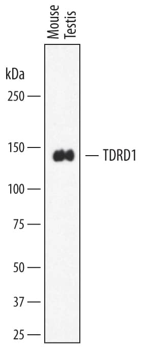Western blot shows lysates of mouse testis tissue. PVDF membrane was probed with 1 µg/mL of Sheep Anti-Mouse TDRD1 Antigen Affinity-purified Polyclonal Antibody (Catalog # AF7320) followed by HRP-conjugated Anti-Sheep IgG Secondary Antibody (Catalog # HAF016). A specific band was detected for TDRD1 at approximately 140 kDa (as indicated). This experiment was conducted under reducing conditions and using Immunoblot Buffer Group 8.