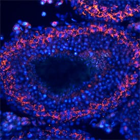 Immunohistochemistry TDRD1 Antibody (739206)