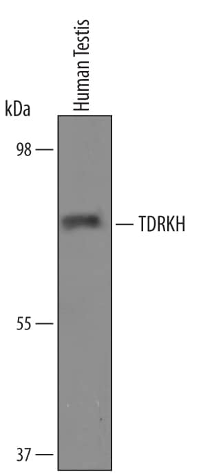 Western Blot TDRKH Antibody