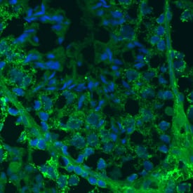 TDRKH was detected in immersion fixed frozen sections of adult mouse testis using Mouse Anti-Human TDRKH Monoclonal Antibody (Catalog # MAB6286) at 10 µg/mL overnight at 4 °C. Tissue was stained using the NorthernLights™ 493-conjugated Anti-Mouse IgG Secondary Antibody (green; Catalog # NL009) and counterstained with DAPI (blue). Specific staining was localized to cytoplasm of germ cells. View our protocol for Chromogenic IHC Staining of Frozen Tissue Sections.