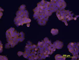 TEM8 was detected in immersion fixed HT-29 human colon adenocarcinoma cell line using Goat Anti-Human TEM8 Isoform 1 Antigen Affinity-purified Polyclonal Antibody (Catalog # AF3886) at 10 µg/mL for 3 hours at room temperature. Cells were stained using the NorthernLights™ 557-conjugated Anti-Goat IgG Secondary Antibody (yellow; Catalog # NL001) and counterstained with DAPI (blue). View our protocol for Fluorescent ICC Staining of Cells on Coverslips.