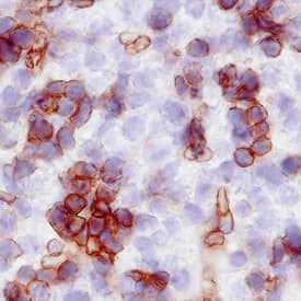 TER-119 was detected in immersion fixed frozen sections of mouse embryo (E15) using Rat Anti-Mouse TER-119 Biotinylated Monoclonal Antibody (Catalog # BAM1125) at 25 µg/mL overnight at 4 °C. Tissue was stained using the Anti-Rat HRP-DAB Cell & Tissue Staining Kit (brown; Catalog # CTS017) and counter-stained with hematoxylin (blue). Specific staining was localized to red blood cell plasma membranes. View our protocol for Chromogenic IHC Staining of Frozen Tissue Sections.